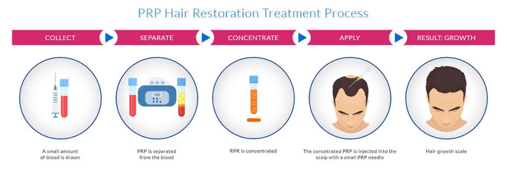 Hair Loss Treatment in Ahmedabad
