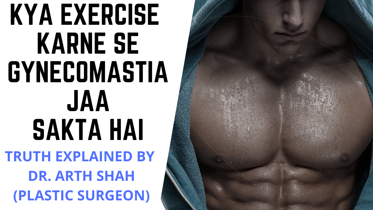 Gynecomastia Doctor in Gujarat