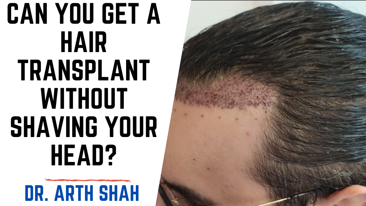 hair Transplant in Gujarat,India