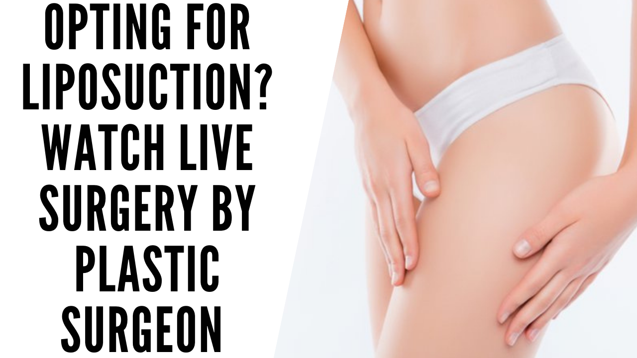 BEST LIPOSUCTION IN AHMEDABAD, GUJARAT