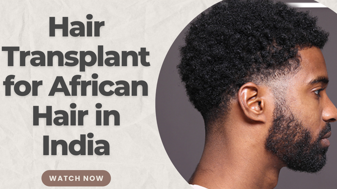Hair Transplant for African Hair in India